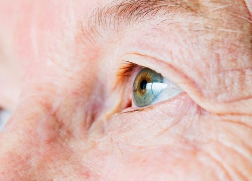 cataract-camp-by-halai-memon-moti-jamat